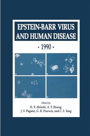 Bild des Verkufers fr Epstein-Barr Virus and Human Disease  1990 zum Verkauf von moluna