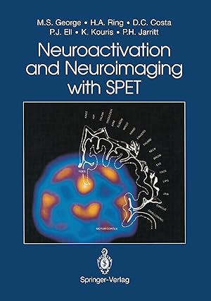 Bild des Verkufers fr Neuroactivation and Neuroimaging with SPET zum Verkauf von moluna