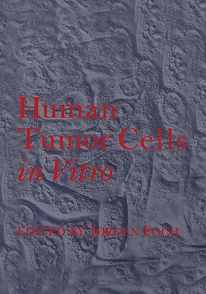 Seller image for Human Tumor Cells in Vitro for sale by moluna