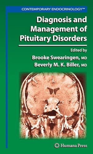Seller image for Diagnosis and Management of Pituitary Disorders for sale by moluna