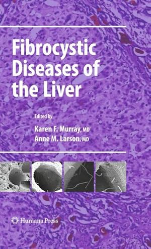 Seller image for Fibrocystic Diseases of the Liver for sale by moluna