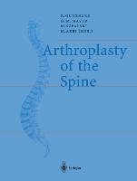 Bild des Verkufers fr Arthroplasty of the Spine zum Verkauf von moluna
