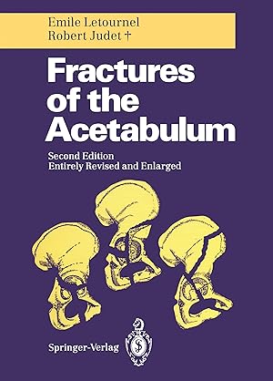 Seller image for Fractures of the Acetabulum for sale by moluna