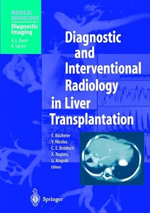 Image du vendeur pour Diagnostic and Interventional Radiology in Liver Transplantation mis en vente par moluna