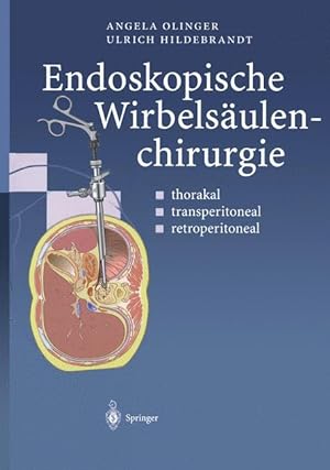 Seller image for Endoskopische Wirbelsaeulenchirurgie for sale by moluna