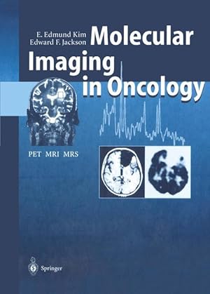 Seller image for Molecular Imaging in Oncology for sale by moluna