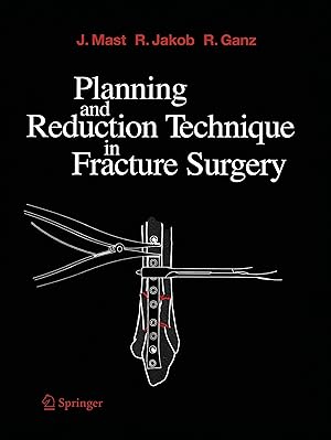 Seller image for Planning and Reduction Technique in Fracture Surgery for sale by moluna