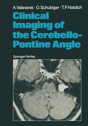 Immagine del venditore per Clinical Imaging of the Cerebello-Pontine Angle venduto da moluna