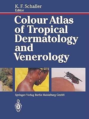 Bild des Verkufers fr Colour Atlas of Tropical Dermatology and Venerology zum Verkauf von moluna