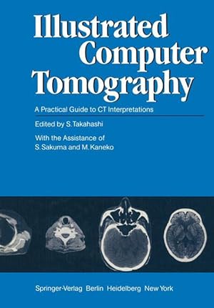 Seller image for Illustrated Computer Tomography for sale by moluna