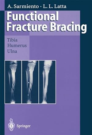Seller image for Functional Fracture Bracing for sale by moluna
