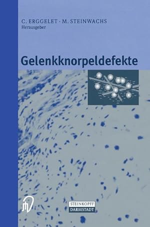Immagine del venditore per Gelenkknorpeldefekte venduto da moluna