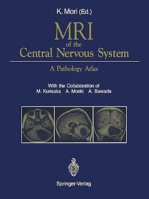 Seller image for MRI of the Central Nervous System for sale by moluna