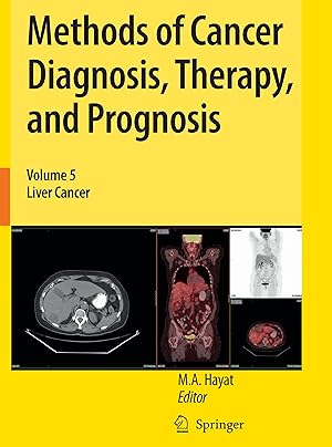 Seller image for Methods of Cancer Diagnosis, Therapy, and Prognosis for sale by moluna