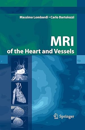 Seller image for MRI of the Heart and Vessels for sale by moluna