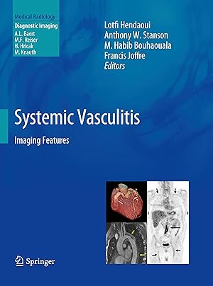 Seller image for Systemic Vasculitis for sale by moluna