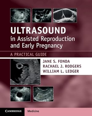 Imagen del vendedor de Ultrasound in Assisted Reproduction and Early Pregnancy : A Practical Guide a la venta por GreatBookPrices