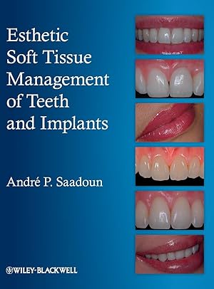 Imagen del vendedor de Esthetic Soft Tissue Management of Teeth and Implants a la venta por moluna