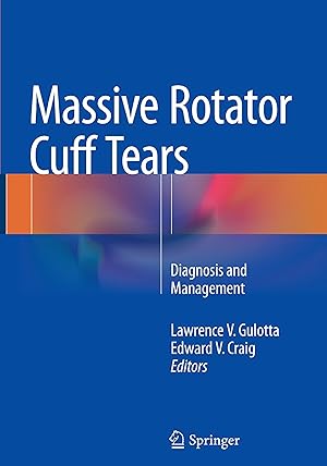 Bild des Verkufers fr Massive Rotator Cuff Tears zum Verkauf von moluna