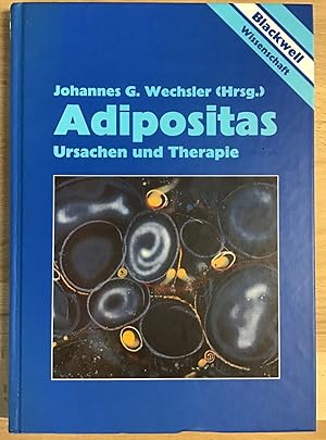 Seller image for Adipositas : Ursachen und Therapie, mit 65 Tabellen. for sale by Antiquariat Peda