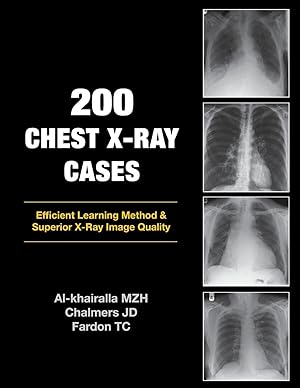 Image du vendeur pour 200 Chest X-Ray Cases mis en vente par moluna