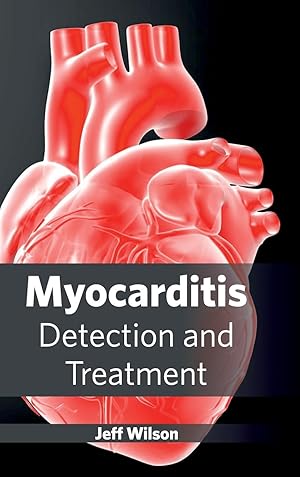 Seller image for Myocarditis for sale by moluna