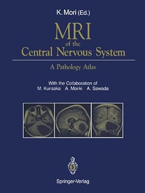 Seller image for MRI of the Central Nervous System for sale by moluna