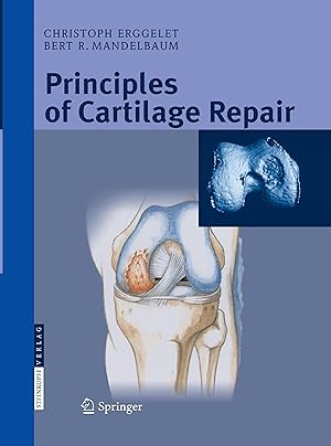 Immagine del venditore per Principles of Cartilage Repair venduto da moluna