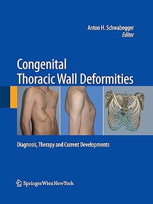 Immagine del venditore per Congenital Thoracic Wall Deformities venduto da moluna