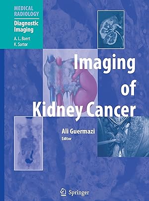 Bild des Verkufers fr Imaging of Kidney Cancer zum Verkauf von moluna