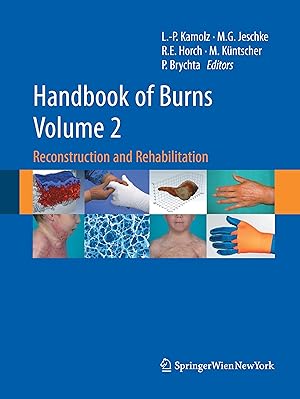 Image du vendeur pour Handbook of Burns Volume 2 mis en vente par moluna