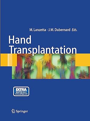 Immagine del venditore per Hand transplantation venduto da moluna