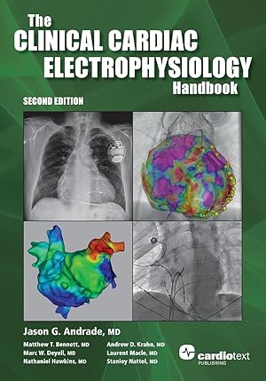 Bild des Verkufers fr The Clinical Cardiac Electrophysiology Handbook, Second Edition zum Verkauf von moluna