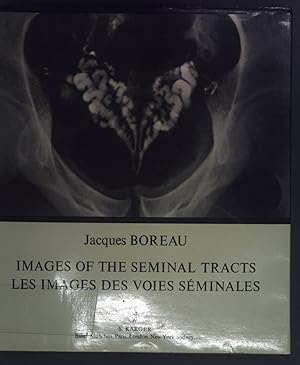 Imagen del vendedor de Les Images des Voies Seminales. Images of the Seminal Tracts. a la venta por books4less (Versandantiquariat Petra Gros GmbH & Co. KG)