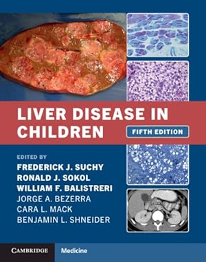 Imagen del vendedor de Liver Disease in Children a la venta por GreatBookPrices