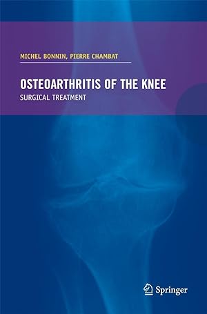 Image du vendeur pour Osteoarthritis of the knee mis en vente par moluna