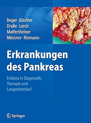 Seller image for Erkrankungen des Pankreas for sale by moluna