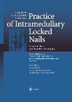 Imagen del vendedor de Practice of Intramedullary Locked Nails a la venta por moluna