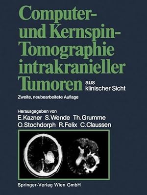 Imagen del vendedor de Computer- und Kernspin-Tomographie intrakranieller Tumoren aus klinischer Sicht a la venta por moluna