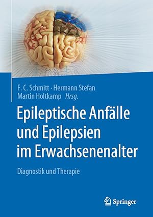 Seller image for Epileptische Anfaelle und Epilepsien im Erwachsenenalter for sale by moluna