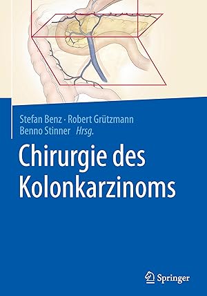 Bild des Verkufers fr Chirurgie des Kolonkarzinoms zum Verkauf von moluna