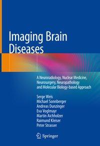 Seller image for Imaging Brain Diseases for sale by moluna