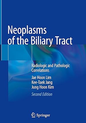 Seller image for Neoplasms of the Biliary Tract for sale by moluna