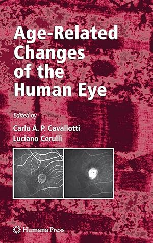 Immagine del venditore per Age-Related Changes of the Human Eye venduto da moluna