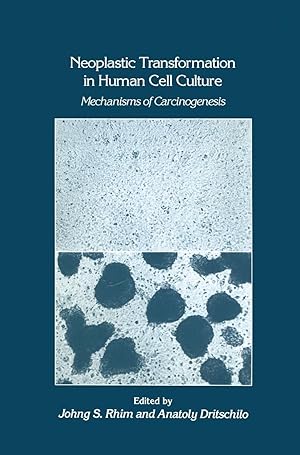 Bild des Verkufers fr Neoplastic Transformation in Human Cell Culture: Mechanisms of Carcinogenesis zum Verkauf von moluna