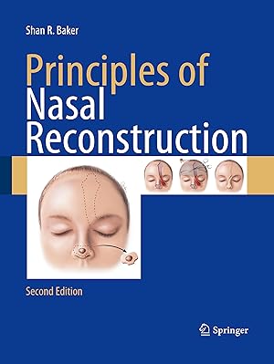 Seller image for Principles of Nasal Reconstruction for sale by moluna