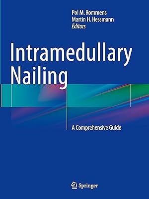 Seller image for Intramedullary Nailing: A Comprehensive Guide for sale by moluna