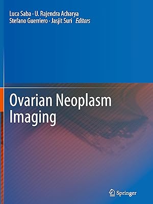 Seller image for Ovarian Neoplasm Imaging for sale by moluna
