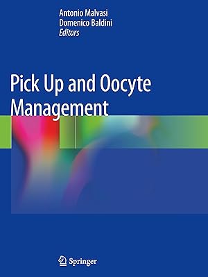 Seller image for Pick Up and Oocyte Management for sale by moluna