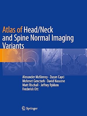 Seller image for Atlas of Head/Neck and Spine Normal Imaging Variants for sale by moluna